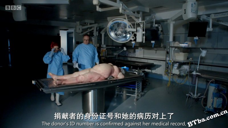 肥胖症:尸检/Obesity The Post Mortem 肥胖症:尸检/Obesity The Post Mortem