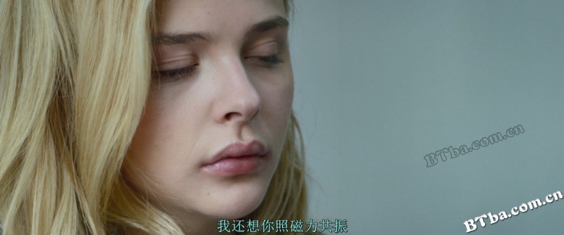 脑火/我发疯的那段日子(台)/我的失常日记(港)/Brain on Fire