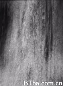 TheHyrcyniumWood-720p|1080p高清bt种子下载