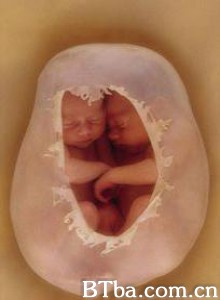 子宫日记：多胞胎/子宫日记：同卵双胞胎/In The Womb-Identical Twins-720p|1080p高清bt种子下载