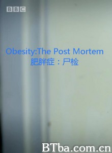 肥胖症：尸检/Obesity The Post Mortem-720p|1080p高清bt种子下载
