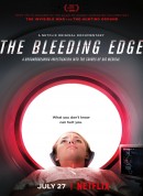 尖端医疗的真相/The Bleeding Edge‎